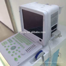 équipement diagnostique portatif d&#39;ultrason médical et scanner de corps d&#39;ultrason et ultrasound avec la couleur de pesudo DW360